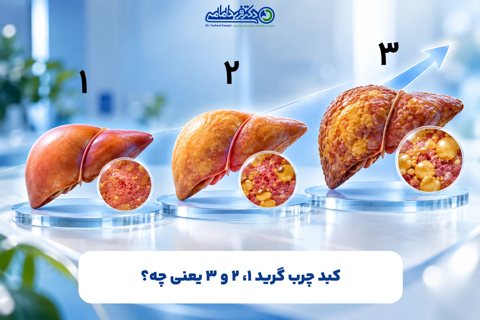 کبد چرب گرید ۱، ۲ و ۳ یعنی چه؟