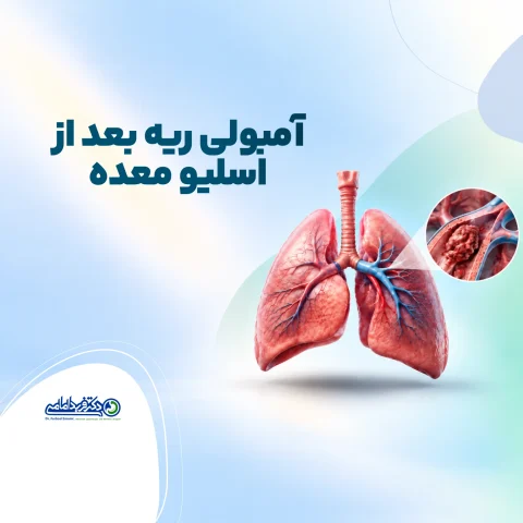 آمبولی ریه بعد از اسلیو معده