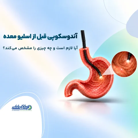 آندوسکوپی قبل از اسلیو معده
