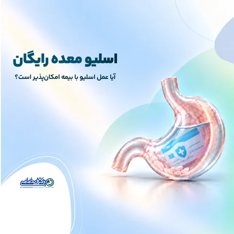 اسلیو معده رایگان