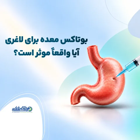 بوتاکس معده برای لاغری
