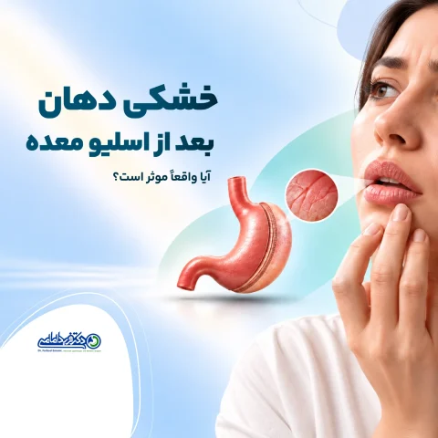 خشکی دهان بعد از اسلیو معده
