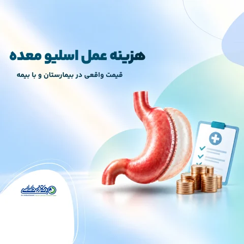هزینه عمل اسلیو معده
