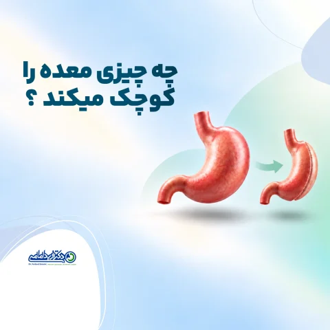 چه چیزی معده را کوچک می‌کند