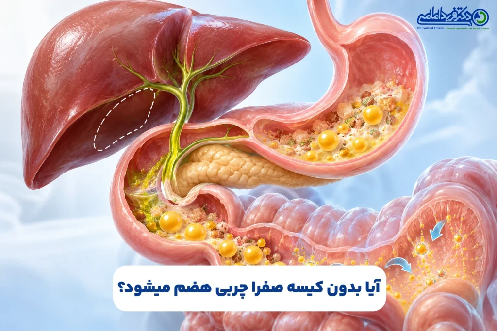 آیا بدون کیسه صفرا چربی هضم میشود؟