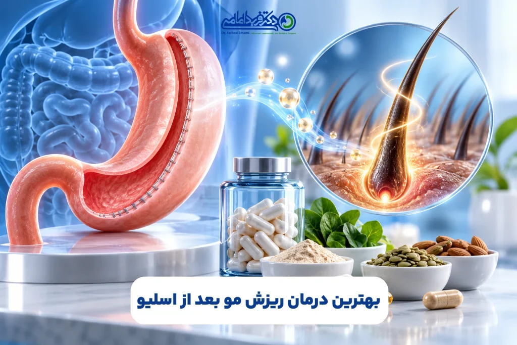 درمان ریزش مو بعد از اسلیو معده