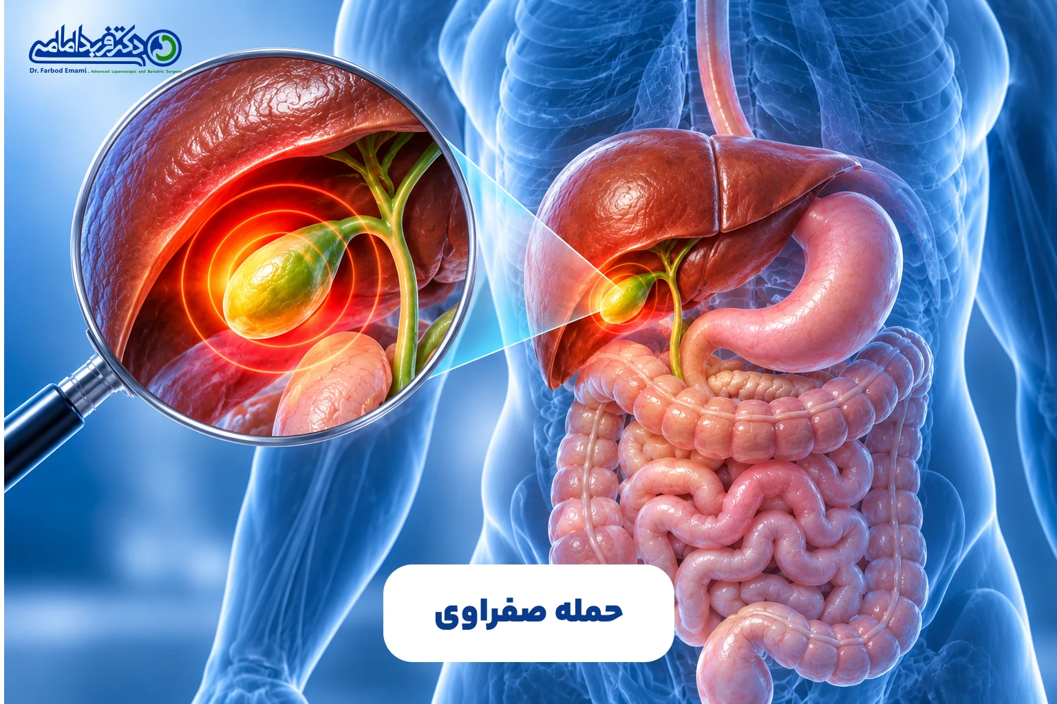 حمله صفراوی