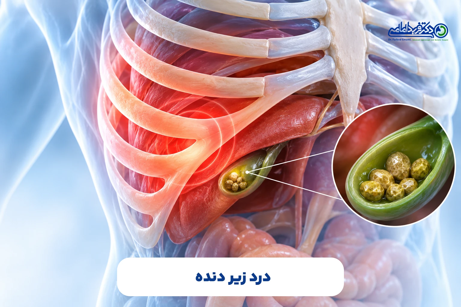 سنگ کیسه صفرا چیست