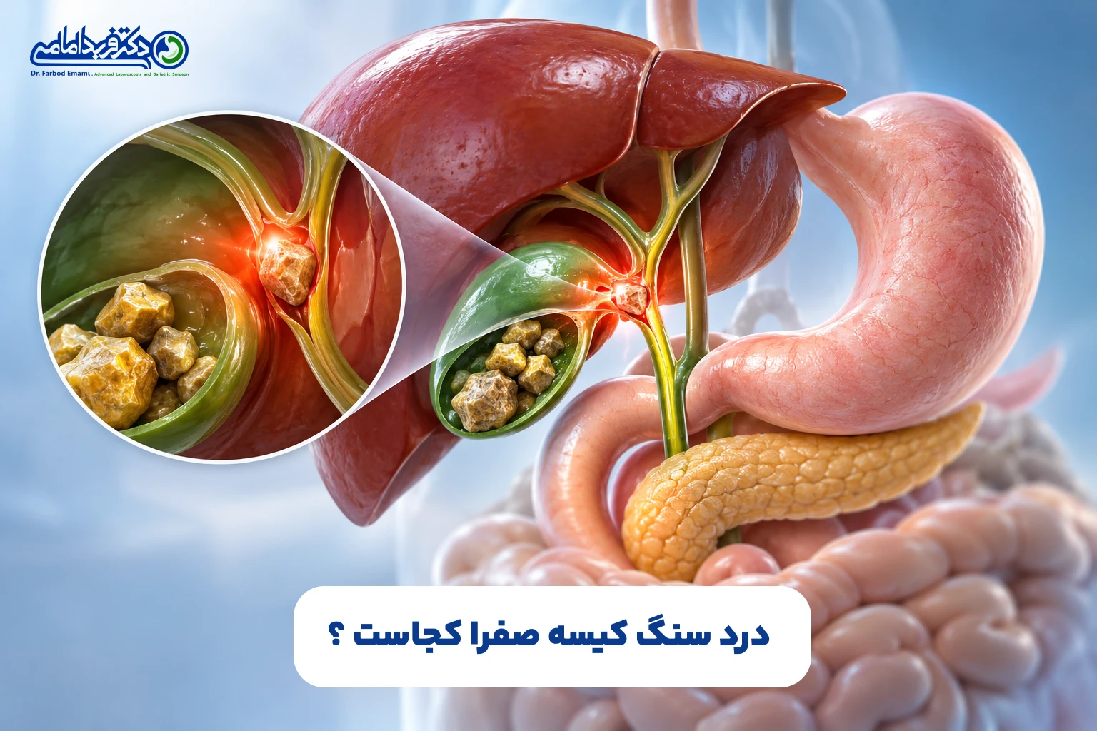 علائم پر شدن کیسه صفرا