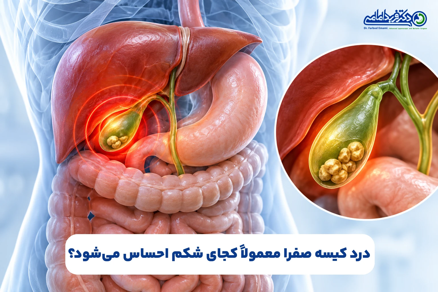 درد کیسه صفرا کجاست