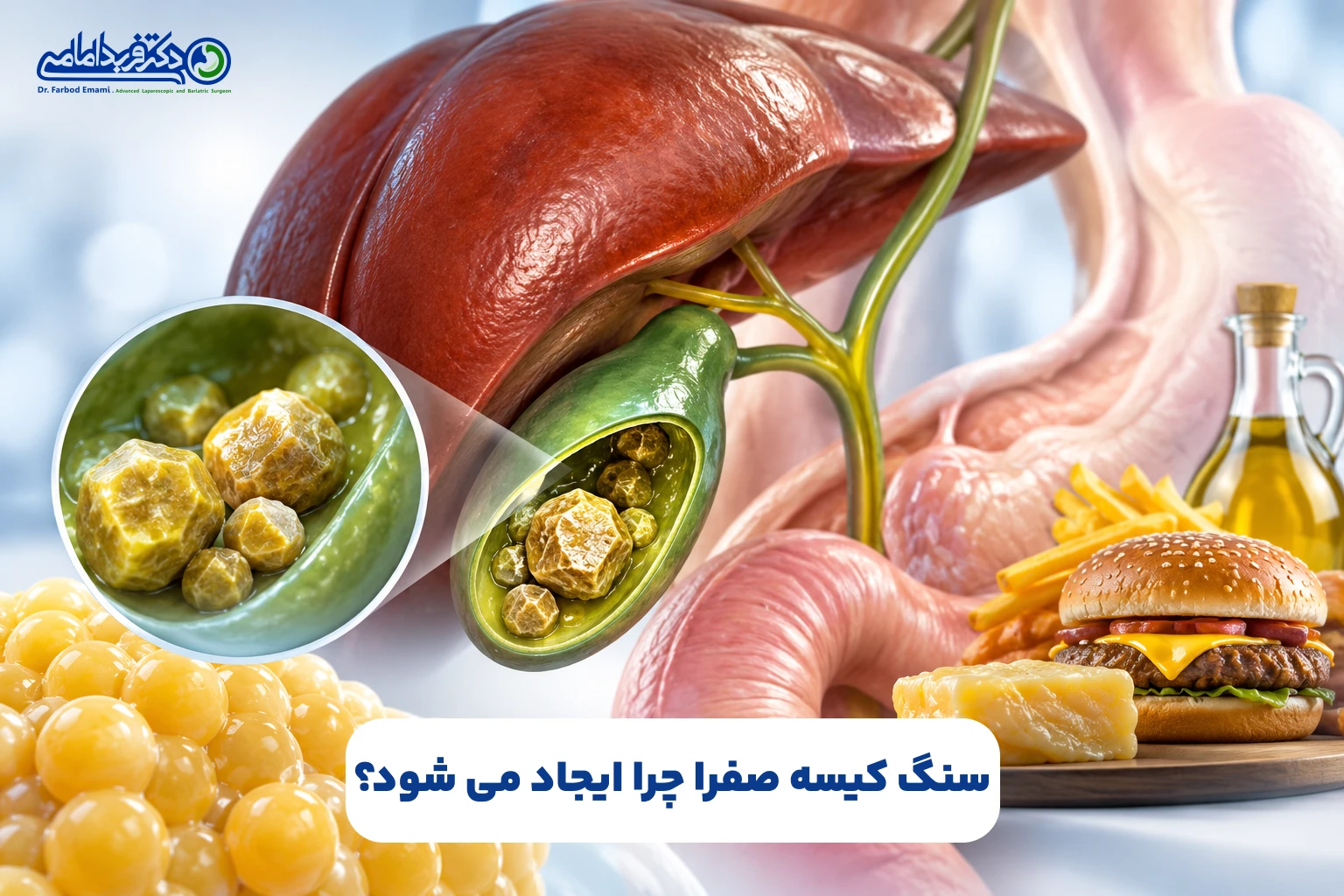 سنگ کیسه صفرا چرا ایجاد می شود؟