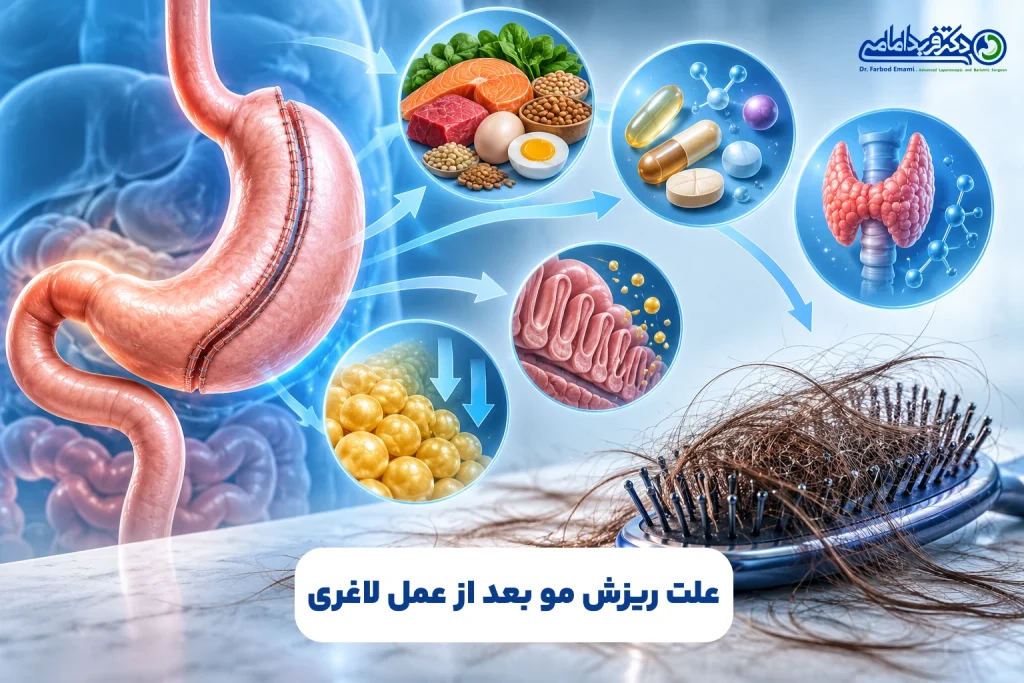 علت ریزش مو بعد از عمل لاغری