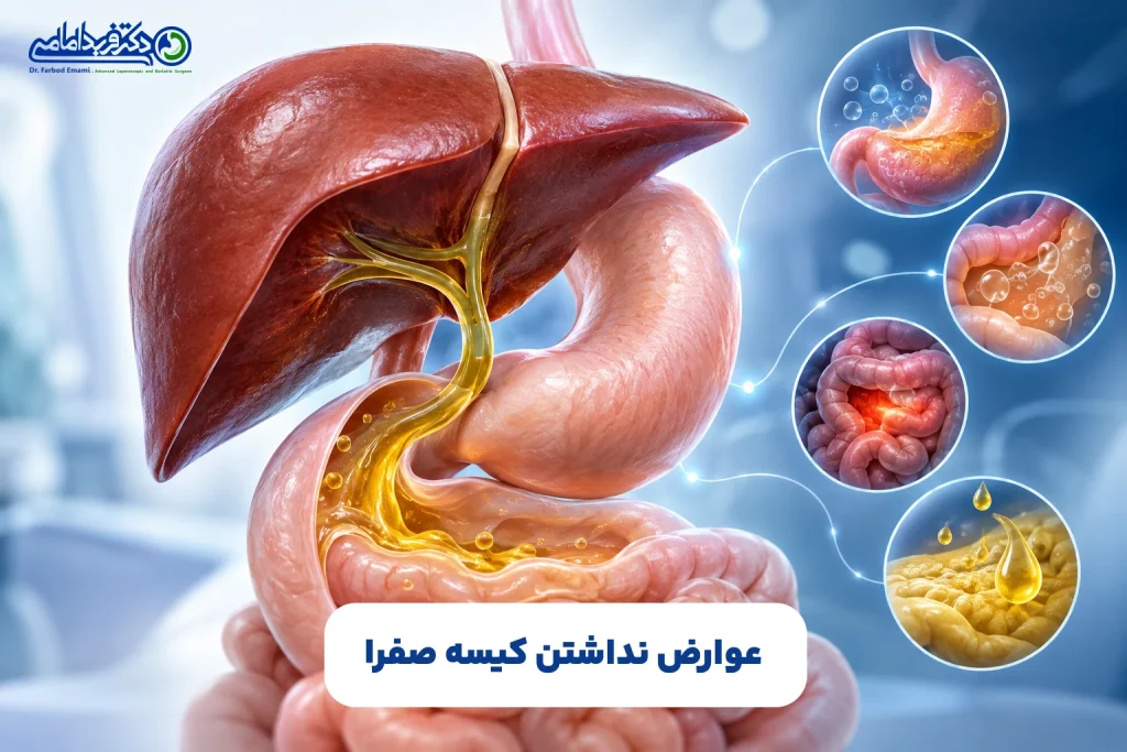عوارض نداشتن کیسه صفرا