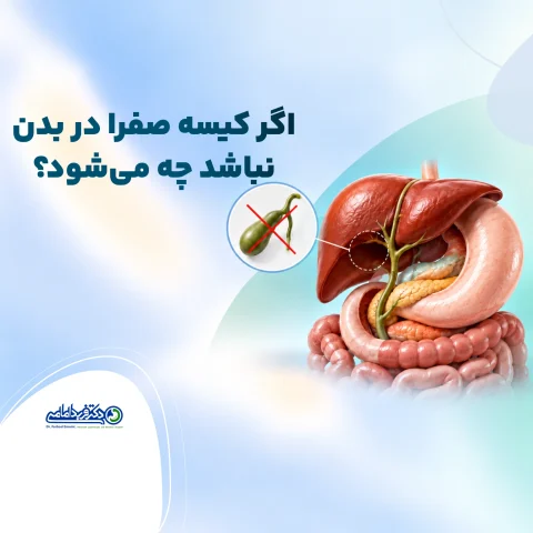 عوارض برداشتن کیسه صفرا