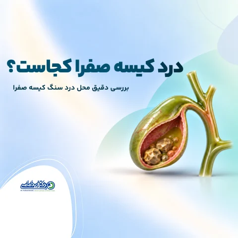 درد کیسه صفرا کجاست