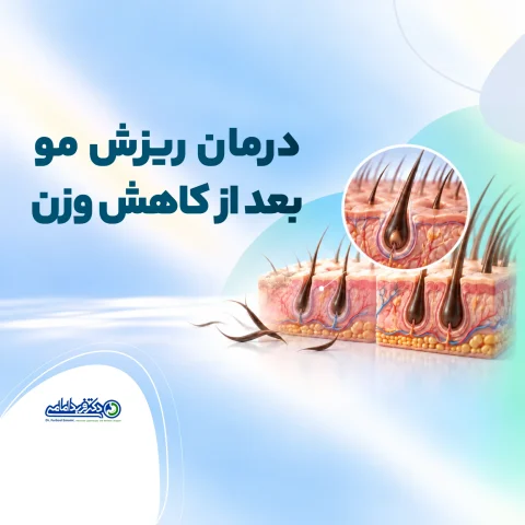 درمان ریزش مو بعد از کاهش وزن
