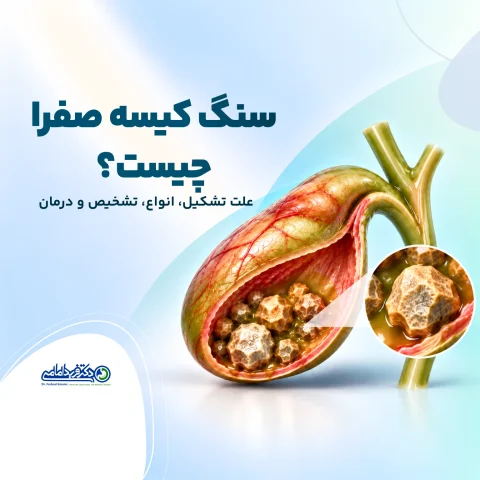 سنگ کیسه صفرا چیست