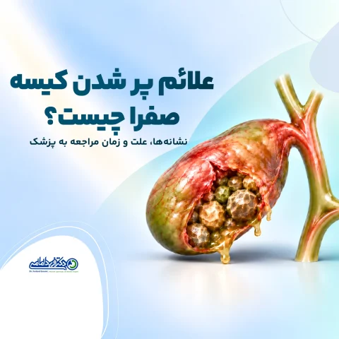 علائم پر شدن کیسه صفرا