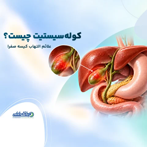 کوله‌سیستیت چیست